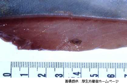 マサバに寄生するアニサキス幼虫の写真（画像提供　厚生労働省ホームページ）