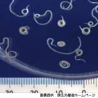 アニサキス虫体の写真（画像提供　厚生労働省ホームページ）1センチメートルから4センチメートル程度の体長